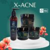 Natural Bundle for Acne Skin
